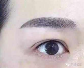 长沙艺星整容怎么样？素颜达人