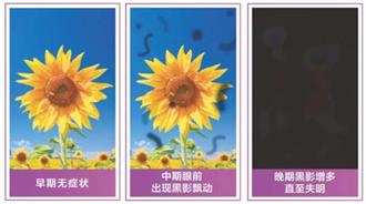 高血糖患者注意！江门爱尔新希望送福利！