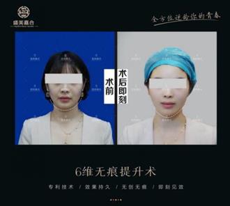 盛美嘉合整形技术太差？厉害了！中国台湾整形大咖何赞嘉入驻杭州盛美嘉合！