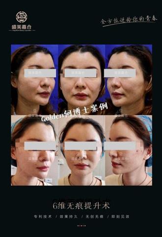 盛美嘉合整形技术太差？厉害了！中国台湾整形大咖何赞嘉入驻杭州盛美嘉合！