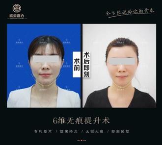 盛美嘉合整形技术太差？厉害了！中国台湾整形大咖何赞嘉入驻杭州盛美嘉合！