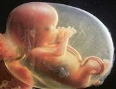 胎兒B超監測最多不超過3次？