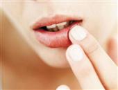 5种食疗方法滋润干燥嘴唇