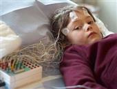 小儿脑瘫表现和治疗方法有哪些