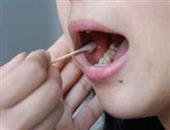 口腔癌术后恢复语言和舌功能