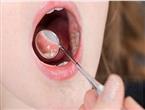 三联片颗粒对反复性、复发性口腔溃疡的临床作用