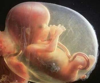 胎儿镜帮你知道胎宝宝情况