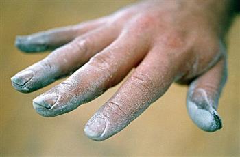 灰指甲感染或与营养不足有关