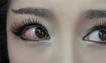青岛出现近五千例红眼病患者半数为中小学生