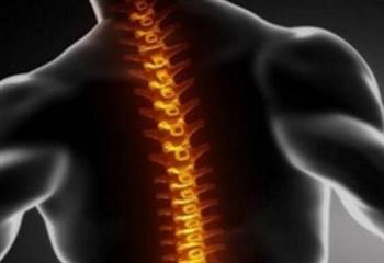 强直性脊椎炎的诊断标准
